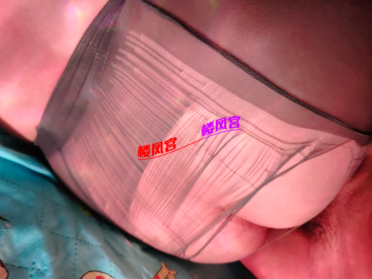 25FF8AA64BF14EAEFBE8B11F14A5B531.png